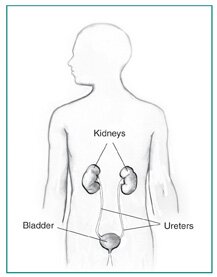 Drawing of the urinary tract in a male figure with labels for the kidneys, bladder, and ureters.